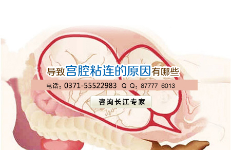 安阳做宫腹腔镜要多少钱